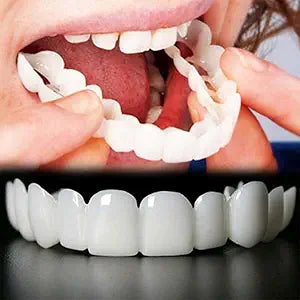 Super Oferta 2x1 SnapSmile Pro
